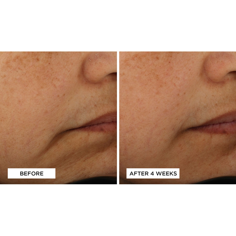 Multi-Action Overnight Intensive Firming Mask